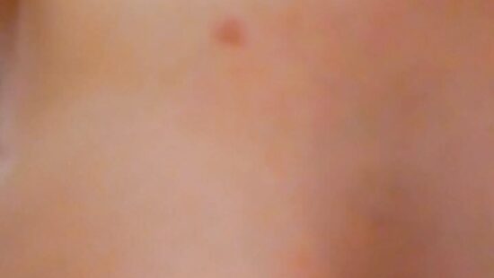 поставил раком